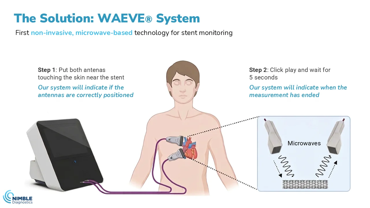Microwaves don't just heat food: they detect tumors, guide cancer therapies, and monitor stents with zero radiation. Discover how this technology is reshaping modern medicine. The solution: Waeve system.